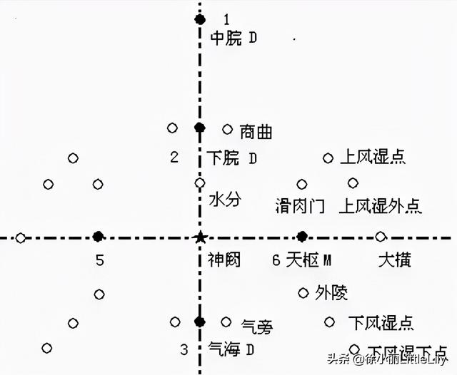 八字疗法专用针具