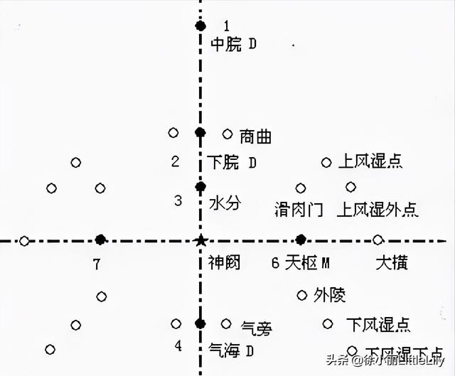 八字疗法专用针具