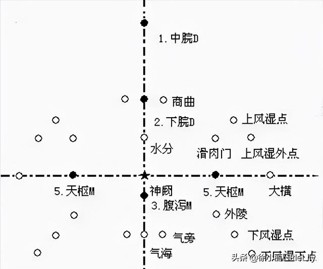 八字疗法专用针具