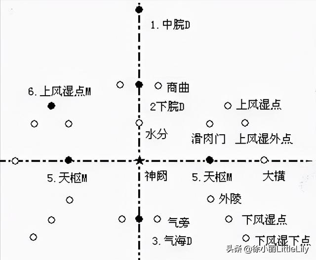 八字疗法专用针具