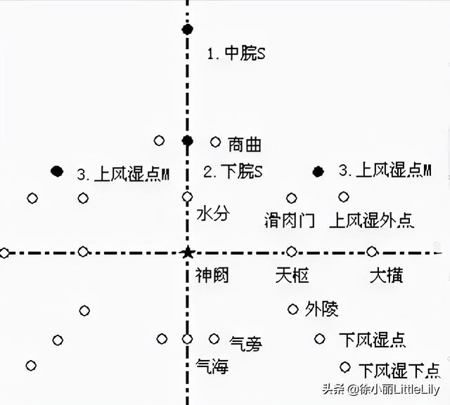 八字疗法专用针具