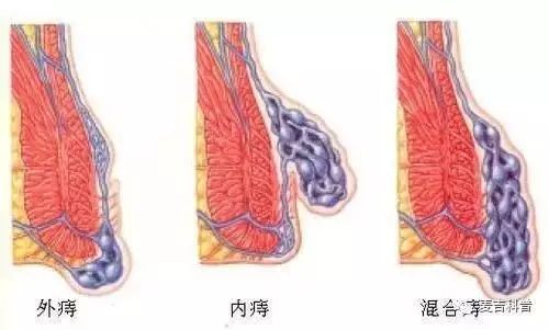 3、怎样才知道是进对了位置图片:女生**次怎么确定进对地方