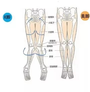 如何纠正内八字(矫正内八字最快的方法)