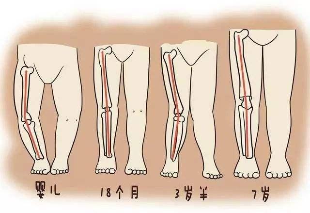 矫正鞋or反穿鞋，内八宝贝到底怎么选？选错小心有危险