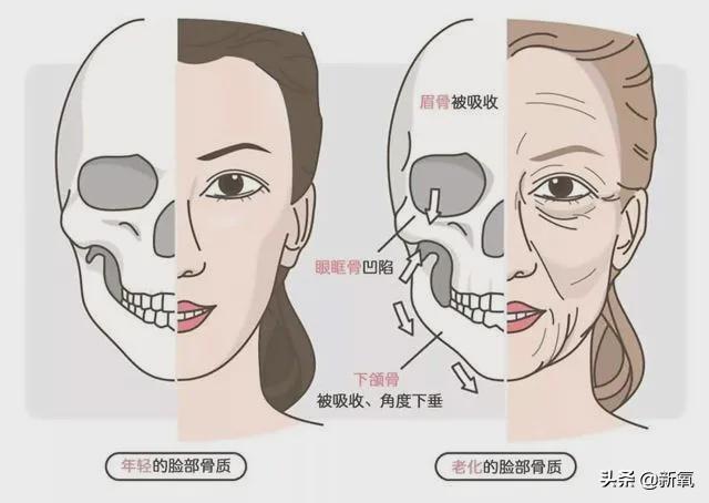 越长大越刻薄脸？如何减缓岁月在我们脸上刻下痕迹的速度？