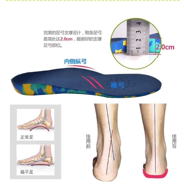 如何矫正内八字腿_如何纠正内八字走路姿势