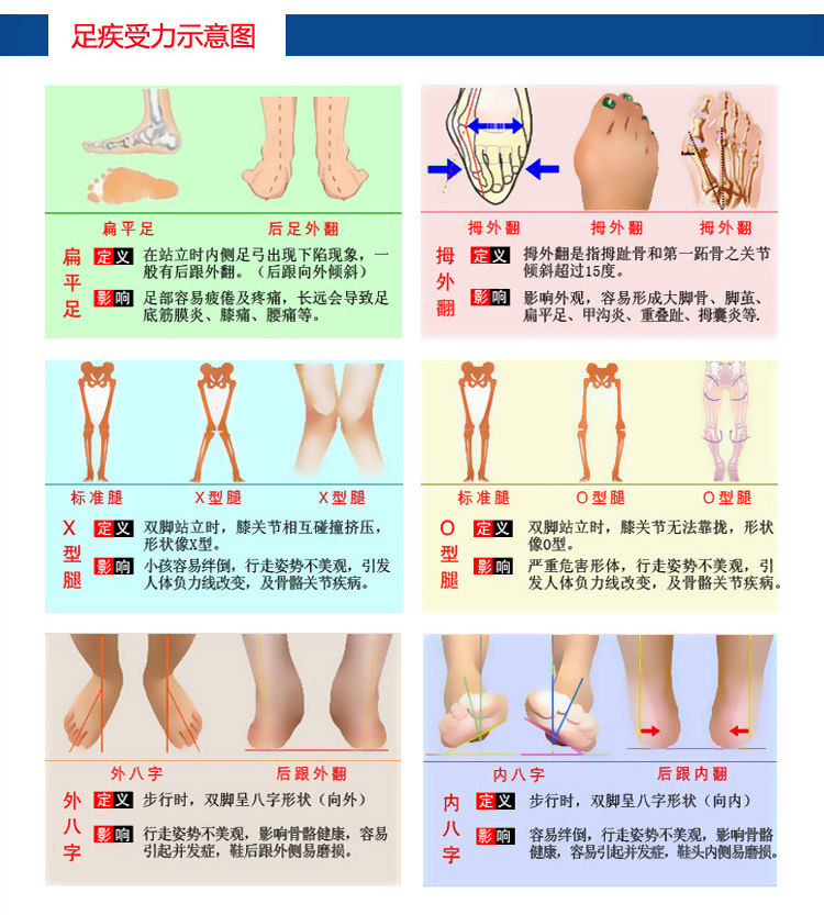 腿内八字怎么矫正_内八字腿训练如何矫正