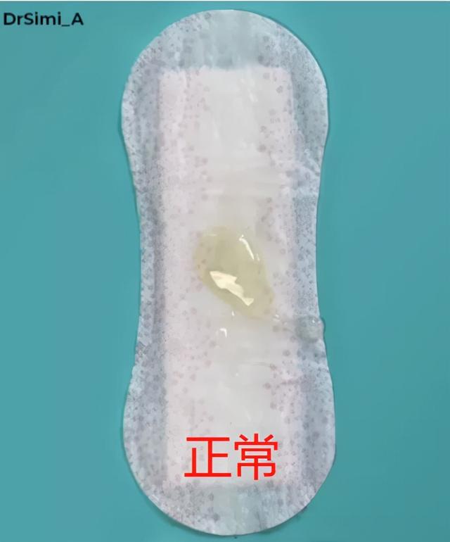 私处分泌物的6种变化，出现这3种颜色赶紧和他一起就医