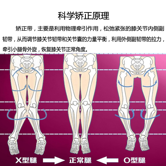 怎么样矫正内八字_走路内八字矫正图解