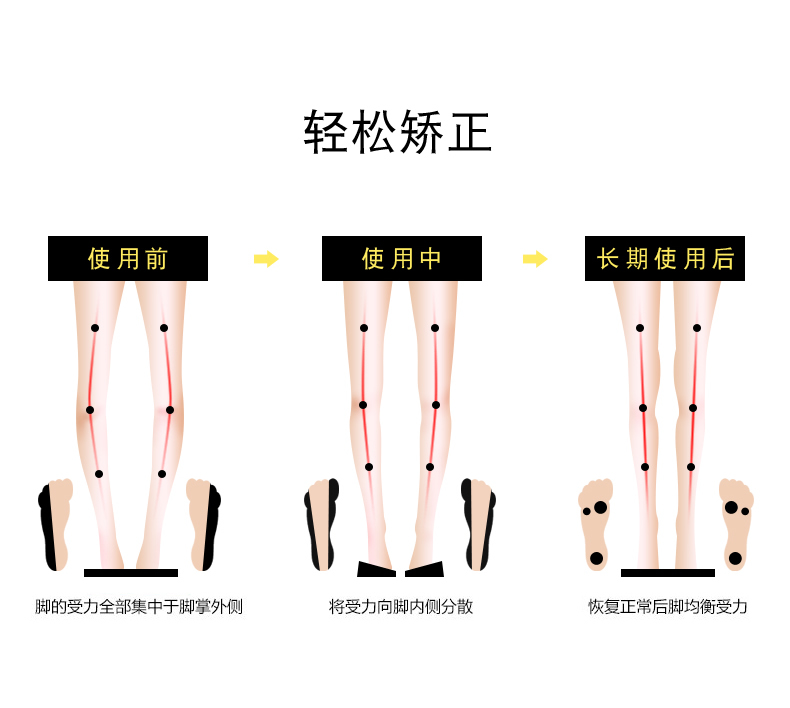 外八字腿_外八字腿型怎么矫正