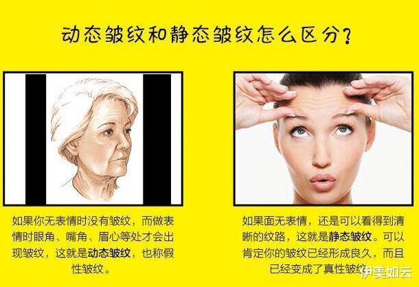 抬头纹命理_抬头纹看命运