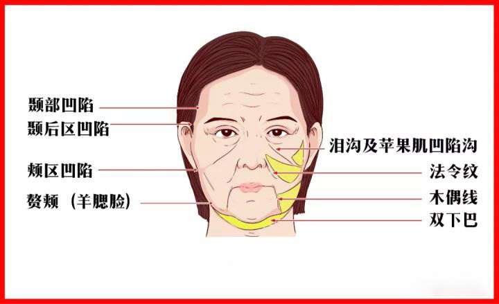 怎样能消除八字纹_正常的法令纹图片