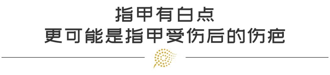 人中长竖纹代表着什么运势如何