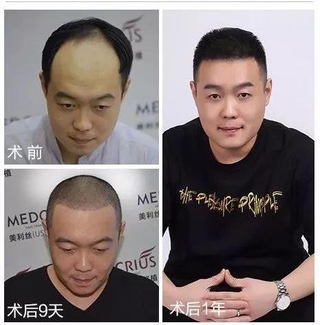 如何改变假发被丢的命运