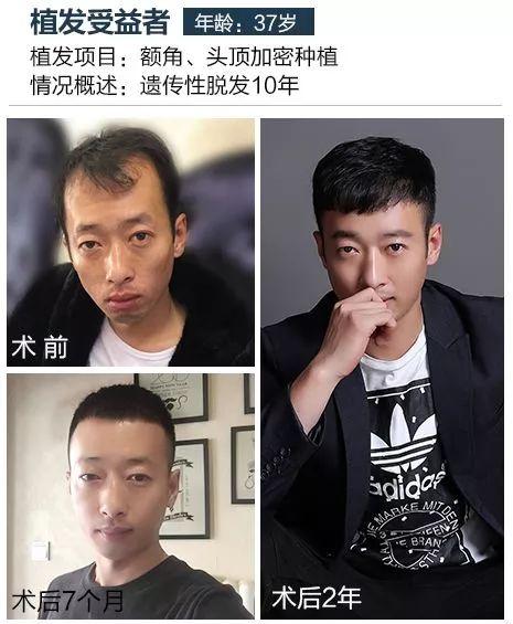 如何改变假发被丢的命运