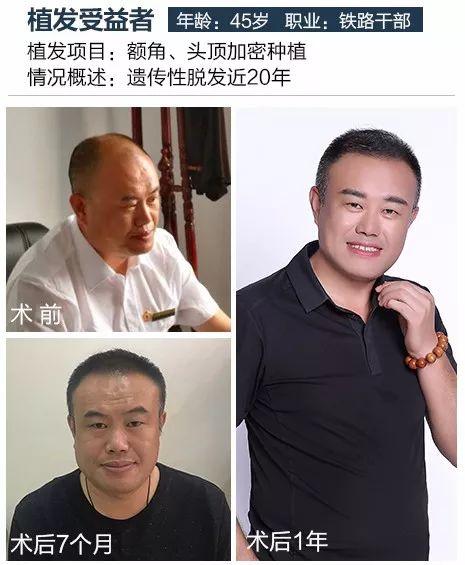 如何改变假发被丢的命运