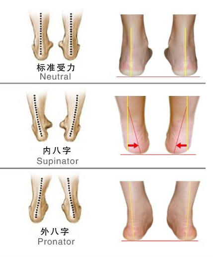 一岁半宝宝走路内八字如何办