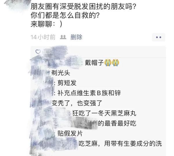 额头两边没头发命运如何