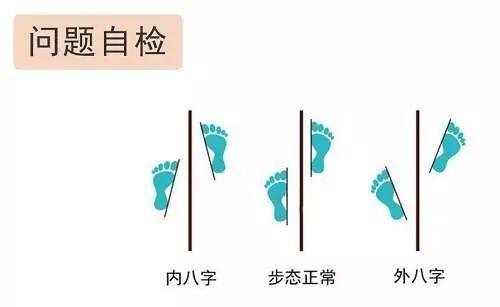 如何纠正内八字走路图