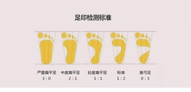 16岁内八字脚如何矫正