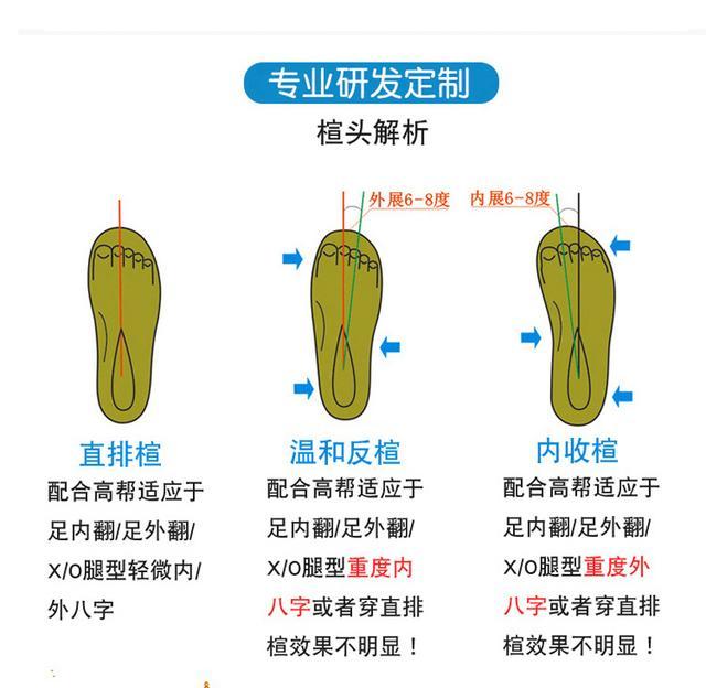 16岁内八字脚如何矫正