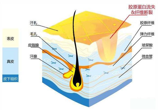 额头有凹疤命运如何破