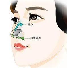 龙鼻子人的命运如何