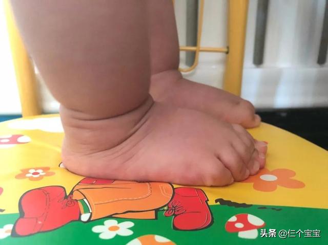 幼儿外八字脚如何矫正