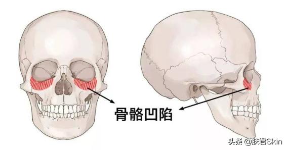 有泪沟纹的人命运如何