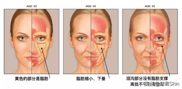 有泪沟纹的人命运如何