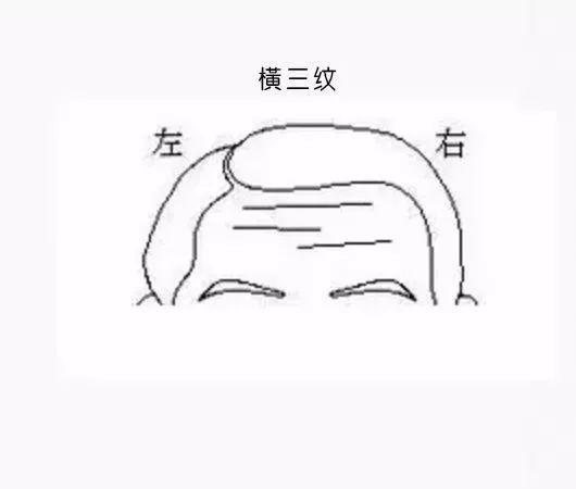 眉心有川字纹的男人命运如何