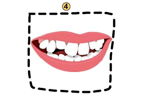 牙齿如何影响你的命运